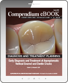 Early Diagnosis and Treatment of Asymptomatic Vertical Enamel and Dentin Cracks Ebook Cover