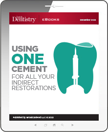 Using ONE Cement for all Your Indirect Restorations Ebook Cover
