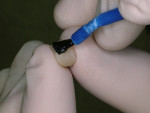 Figure 1  Application of a petroleum jelly with a disposable brush to the cervical third of the provisional crown to facilitate the removal of excess provisional cement.