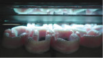 A capture of the PolyJet printing process on a J5 build tray with support structures encapsulating the digital dentures.