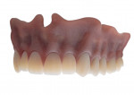 The TrueDent printed denture after the support structure has been removed via the water jet process and then cured in the TrueDent Curing Box.