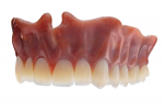 The polished TrueDent denture. Note the incisal translucency and variation of shades.