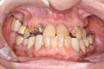 Fig 10. Initial clinical situation, intraoral view.