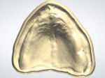 Fig 8. Digital master models derived from the scanned master impressions as viewed from the occlusal view of the maxillary and mandibular arches.
