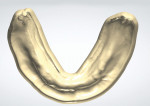 Fig 9. Digital master models derived from the scanned master impressions as viewed from the occlusal view of the maxillary and mandibular arches.