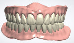 Fig 12. The designed digital dentures articulated as viewed from the right, frontal, and left.