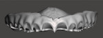 Fig 15. The virtual maxillary denture base that was designed as viewed from the right, frontal, and left views.