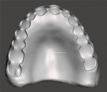 Fig 17. The virtual maxillary denture base that was designed as viewed from the cameo (tooth side) and intaglio (tissue) views.
