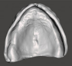 Fig 18. The virtual maxillary denture base that was designed as viewed from the cameo (tooth side) and intaglio (tissue) views.