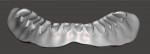 Fig 20. The virtual mandibular denture base that was designed as viewed from the right, frontal, and left views.