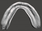 Fig 23. The virtual mandibular denture base that was designed as viewed from the cameo (tooth side) and intaglio (tissue) views.