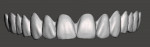 Fig 25. The designed digital denture teeth for the maxillary arch as viewed from the right, frontal, and left.