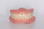 Fig 37. The finished 3D printed dentures articulated and ready for delivery to the patient.