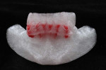 (4.) A dual-color FFF 3D-printed diagnostic model of a patient’s mandible.
