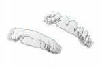 SureSmile Aligners are high performance clear aligners that facilitate effective tooth movement and many clinical options—even for complicated cases. After uploading patient records into the open software, dentists can specify their own preferences or rely on SureSmile’s Digital Lab to propose customized treatment plans.