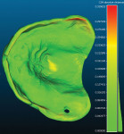 Fig 14. The 3D printed dentures are scanned into CAD software to assess the fidelity to the digital design file. Red is least accurate and green is most accurate. Clearly, the polyjet 3D printing process produced extremely high dimensional accuracy.