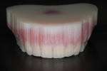 Fig 10. After the print cycle is completed, the printed dentures are removed from the build tray. The unique encapsulated support scaffolding structure eliminates variables of distortion during printing.