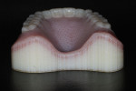 Fig 11. From a posterior perspective, the denture base intaglio and teeth are supported, providing a high-fidelity fit and superior adaptation of the base. With analog dentures, posterior palatal adaptation has always been a problem during polymerization of acrylic resin.