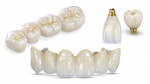 BruxZir® Zirconia offers leading, lasting, and life-changing solutions for dentistry’s everyday challenges.