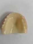 Fig 6. Occlusal view of the immediate PMMA denture.