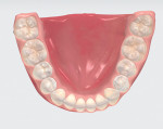 Fig 13. Post-orthodontic treatment scan, mandibular occlusal view.
