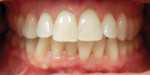 Fig 2. Pretreatment, frontal intraoral view.