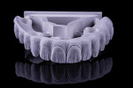 Fig 5. The CAD/CAM-fabricated, milled zirconia prosthesis had retentive recesses incorporated to enable the chairside pick-up of the LOCATOR FIXED housings. The contour, surface texture, and anatomy were to be finalized post-milling.