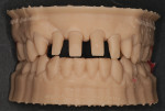 Fig 15. The core file was used to 3D-print a Geller model.