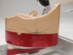 Fig 8. The alveolar ridge contour on the outer side of the model and main chewing center in the mandible (blue).