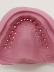 Fig 21. The silicone matrix (Shore hardness 65-75) with perforations at the cusp tips.