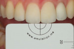 (8.) White balance gray reference card photograph acquired with a cross-polarization filter. This allowed the dental technician to determine the exposure that was used on the dentist’s camera when the definitive implant crown was tried in, confirm the correct core shade for the crown, and confirm that stain and glaze would produce ideal esthetics for this patient.