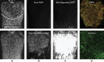 Fig 1. Typical buccal
surface images
top row of images
is from the Philips
Sonicare Power
Flosser 3000 with
Quad Stream nozzle
row of images
is from the control
group. (A) Images of
the surfaces before
placement in the in
vitro model with a
white arc line marking
the gum line and
a black rectangle
marking the deepest
2 mm of the pocket
used for analysis.
(B) After PSPF
treatment or control
(showing effect of
handling). (C and
D) After 48 hours,
biofilm regrowth.
Images (A) through
(C) are captured
with cross-polarized
light microscopy
and images (D) are
captured with confocal
laser scanning
microscopy (1000x
magnification) with
an image size of 40
μm x 40 μm.