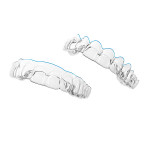 SureSmile® Clear Aligners
from Dentsply Sirona.