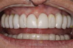 Figure 27  Information photo of changes to incorporate into definitive restorations.