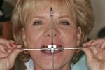 Figure 9  Kois Dento-Facial Analyzer positioned level.