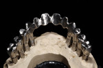 Figure 48  Lingual/occlusal view of framework on master model.
