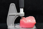 Figure 16  The denture gauge establishes the location both vertically and horizontally of the future incisal edge. This is the reference point for the central papilla.
