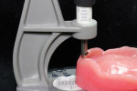 Figure 18  The wax rim is verified with the new vertical dimension established by the denture gauge.