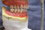 Figure 8  Function of posterior teeth.