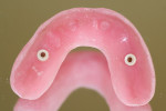Figure 17  The intaglio surface of the finished maxillary basebar. Note that the accurate vertical stops are to rest on healing caps in the area of teeth Nos. 8 and 9.