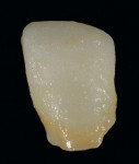Figure 11  Lava DVS stain was applied to the neck and incisal tip of the coping.