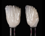 Figure 28  A study of the layered crown shows a deep understanding of the observation of natural dentition.