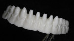 Figure 8  The zirconia framework was milled using CAM technology.