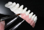 Figure 10  IPS e.max Ceram Zirliner was applied to the gingival areas then enhanced with berry and rose IPS e.max gingival stains.
