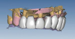 Figure 2  Orientation of the anatomical tooth shapes.