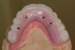 Figure 7  An occlusal view of the maxillary.