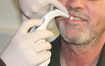 Figure 3  Determining the correct tooth shade—5M1—with Easyshade Compact.