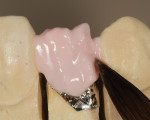 Figure 14  The dentin was applied in a B-2 base.