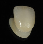 Figure 30  The gingival area was given an orange hue.