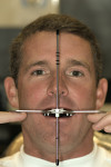 Figure 12  Kois Dento-Facial Analyzer.